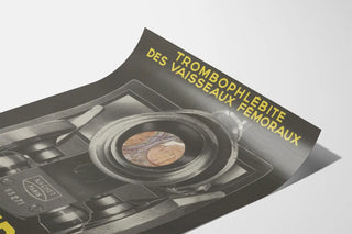 bi-citrol-marinier-trombophlebite-des-vaisseaux-femoraux