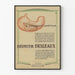 Vintage-Poster Le pansement gastrique Bismuth Desleaux