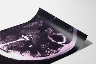 ct-scan