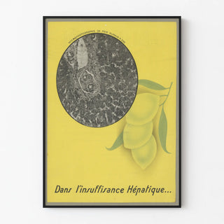 dans-linsuffisance-hepatique