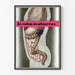 Vintage-Poster Medizinische Anatomie – Der schmerzhafte Dickdarm