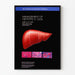 Vintage medizinischer Poster zur Hepatitis-C-Management 2002