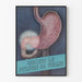 Anatomisches Poster des Pylorus und Magens – Medizinische Wanddekoration