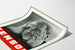 Vintage-Werbeplakat TENSOL gegen Schwindel und Bluthochdruck