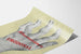Vintage-Poster mit deformierter Hand gegen Rheuma - Urodonal