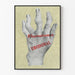 Vintage-Poster mit deformierter Hand gegen Rheuma - Urodonal